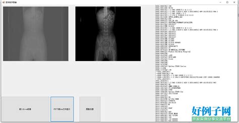 手机打开dcm格式(手机打开dcm格式图片)缩略图