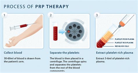 prp格式(prp格式的用什么软件打开)缩略图