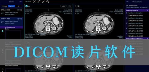 dicom格式图片(dicom格式图片用什么软件打开)缩略图