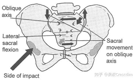 骶髂是哪里,骶髂是哪里图片缩略图