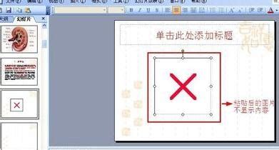 cad dcl格式无法显示,cad的dcl文件出现问题怎么修复缩略图